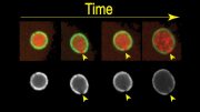 Yale Researchers Track How Cells Repair Rips in DNA’s Protective Membrane